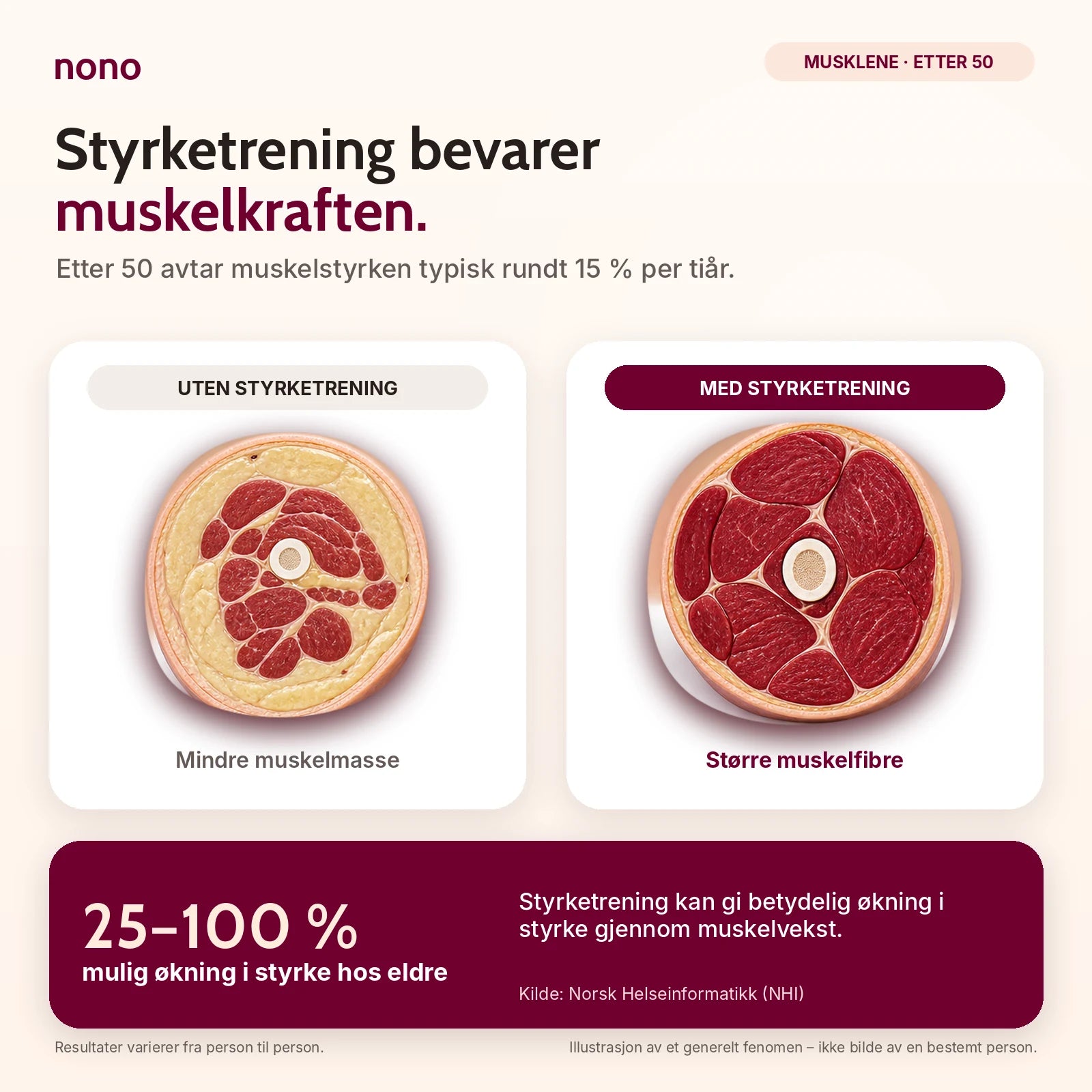 Musklene etter 50: uten styrketrening blir muskelmassen mindre, med styrketrening blir muskelfibrene større. Kilde: Norsk Helseinformatikk.